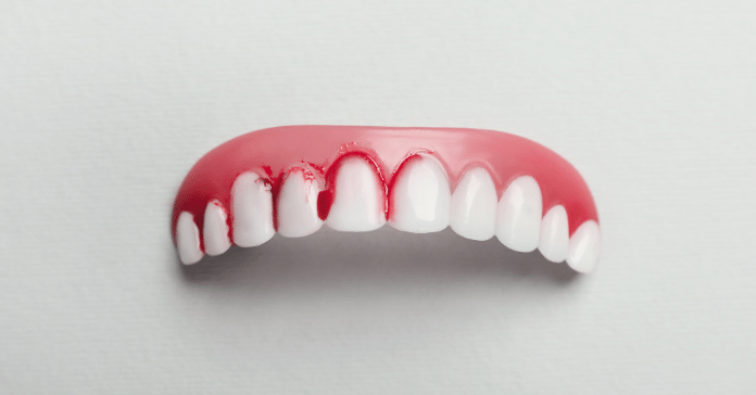 Close-up illustration showing bleeding gums along the edges of the teeth caused by gum inflammation.