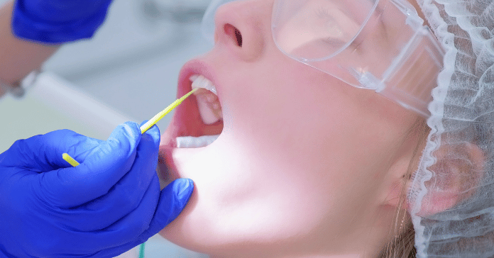 Dental professional applies fluoride treatment to teeth to strengthen enamel and reduce sensitivity.