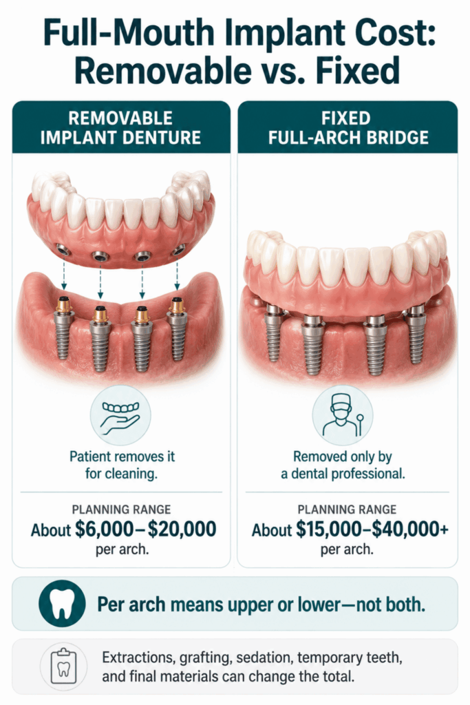 Full-mouth implant cost comparison of a removable implant denture and fixed full-arch bridge per arch.