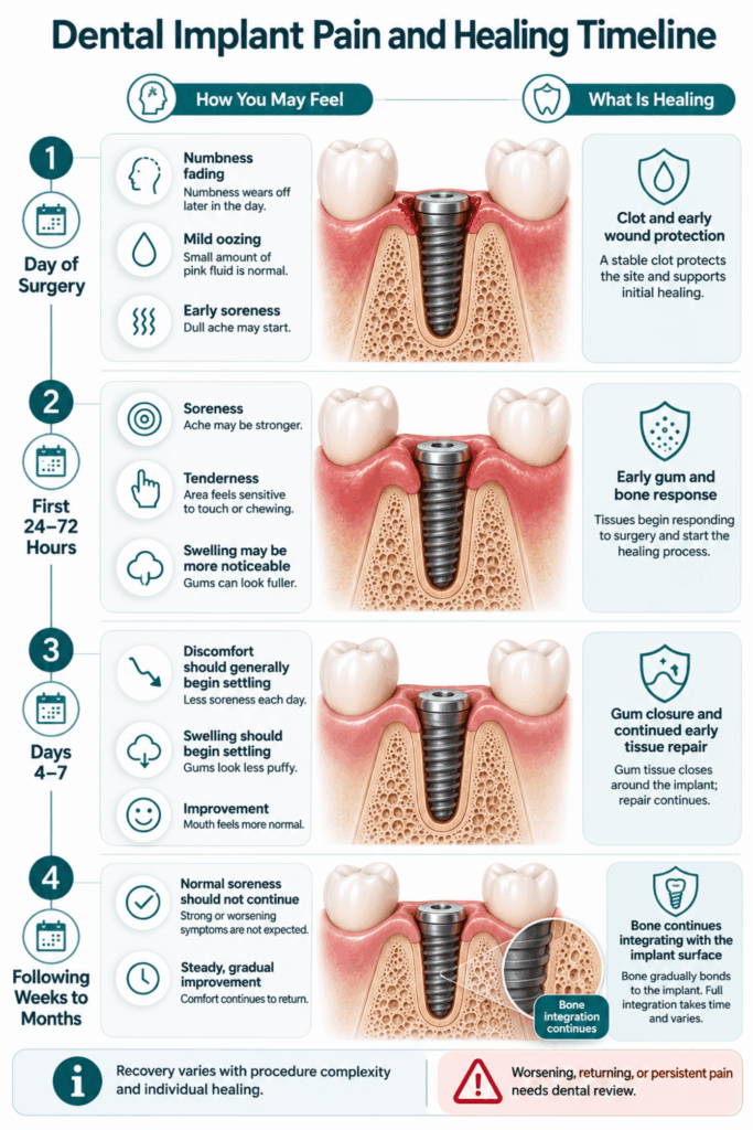 Four-stage dental implant pain timeline showing symptoms from surgery day through bone integration