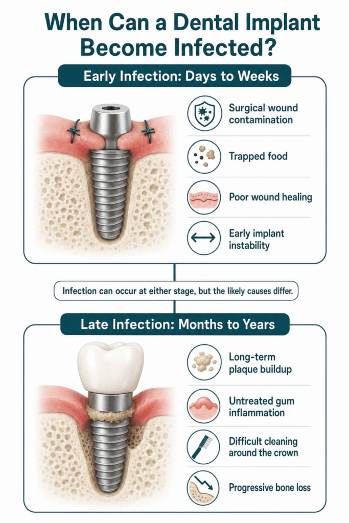 Timeline comparing early implant infection after surgery with late infection caused by plaque and inflammation