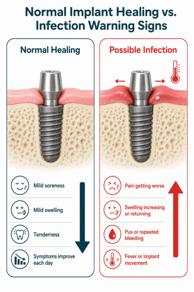 Side-by-side comparison of normal implant healing symptoms and worsening signs of possible infection