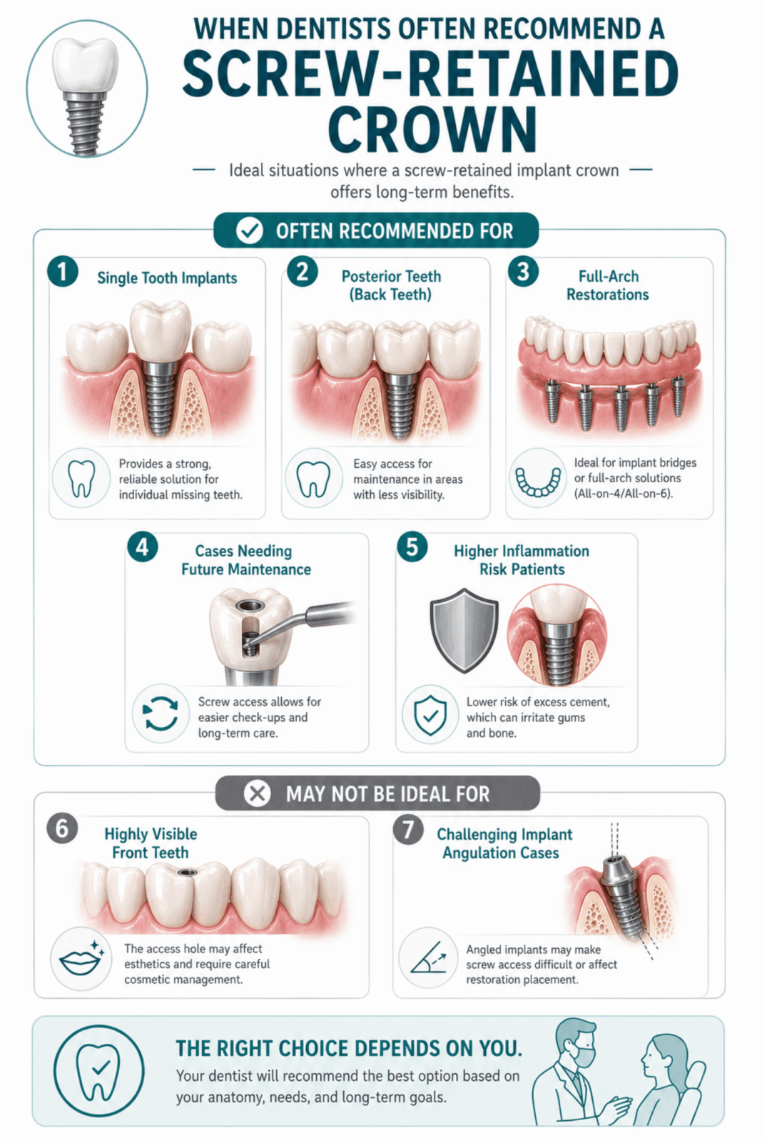 Screw Retention Feature Screw-Retained Implant Crown: What It Is and How It Works - Share ...